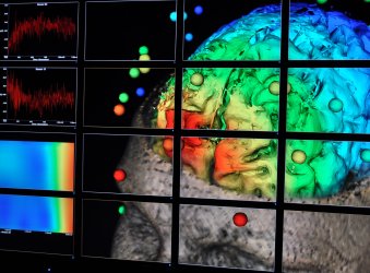 visualization of the human brain using VisTrails