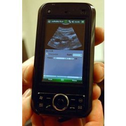 smartphone showing ultrasound image