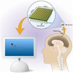 BrainGate technology illustration