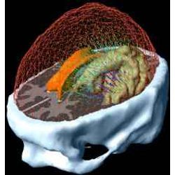 tumor simulation model