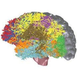 brain image mapped with BlueMatter algorithm data