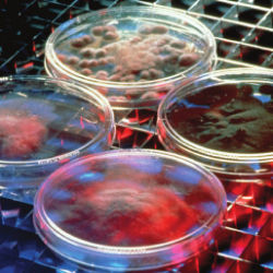 petri dishes