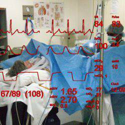 view from head-mounted display during surgery