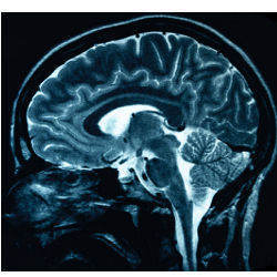 brain x-ray