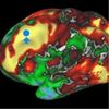 Mapping the Brain on a Massive Scale