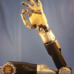 Bionic arm