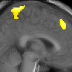 brain image highlights neural activity 