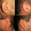 Could Ears Be the Perfect Biometric?