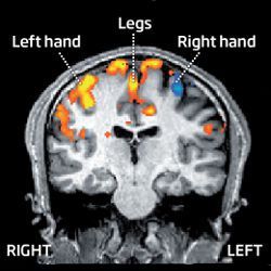MRI of motor cortex 