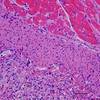 Image Analysis May Allow Pathologists to Expedite Diagnoses