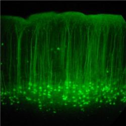 Mouse somatosensory cortex