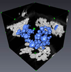 A high-resolution 3-D electron microscopy reconstruction of aluminum nanoparticles