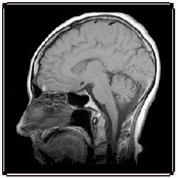 An MRI scan of the human head. 