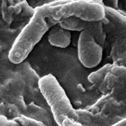Pseudomonas aeruginosa bacteria.