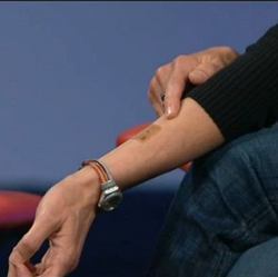 The BioStamp electronic tattoo. 