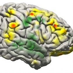 An image showing activity in the brain when using a brain-computer interface.