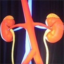 Holographic kidney