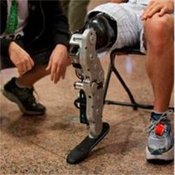 Robotic prosthetic leg