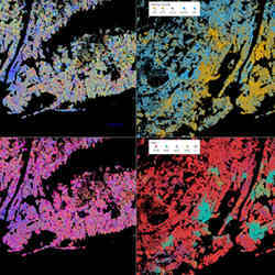 Four views of the New York City area, each highlighting different demographic patterns.