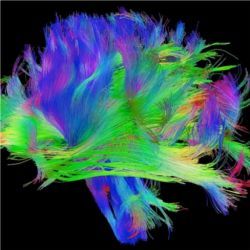 Map of human neural circuits