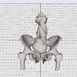 Digital imaging of a pregnant mother's pelvis could help determine in advance how a birth will occur.