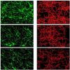 Computer Simulation of Blood Vessel Growth