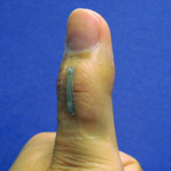 A sensor based on silver nanowires is mounted onto a thumb joint to monitor the skin strain associated with thumb flexing.