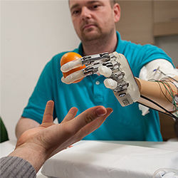 Prosthetic hand, with feeling