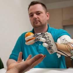 An amputee wearing a sensory feedback-enabled prosthesis holds an orange.