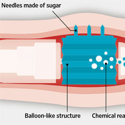 Robotic pill