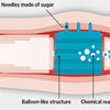 Can 'robotic' Pills Replace Injections?