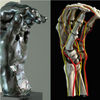 Stanford Medical Technology Exposes Hidden Maladies of Sculptor Auguste Rodin's Celebrated Hands