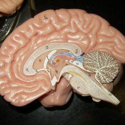 model of the human brain