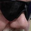 Michigan Man Among 1st in U.s. to Get 'bionic Eye'