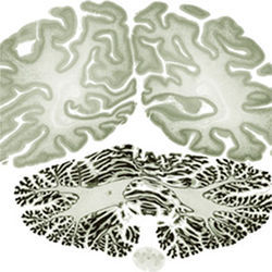 Section of human brain map