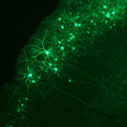 green fluorescent protein-labeled neurons