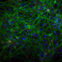 Hippocampal brain cells.