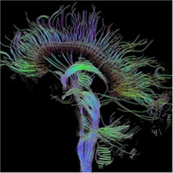 Nerve fibers in human brain