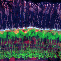 Retinal nerve cells