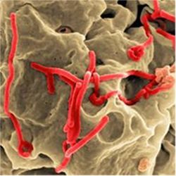 Ebola virus (red)