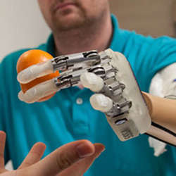 The worlds most advanced bionic hand, providing a sense of touch acute enough to handle an egg, has been completed after 10 years of EU-funded research.