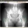 Software to Automatically Outline Bones in X-Rays
