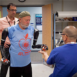 Mind-controlled prosthetic arms