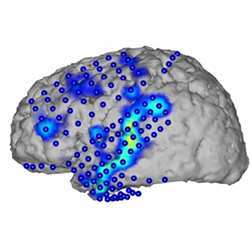 Brain activity recorded by electrocorticography (blue circles). From the activity patterns (blue/yellow), spoken words can be recognized.