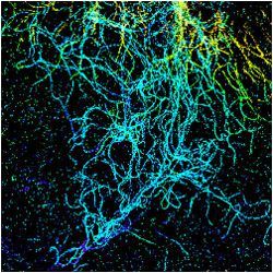 spectrally resolved super-resolution microscopy image