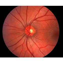 An image of a retina.