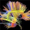 'wiring Diagrams' Link Lifestyle to Brain Function