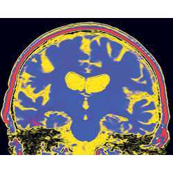 An internal view of the human brain.