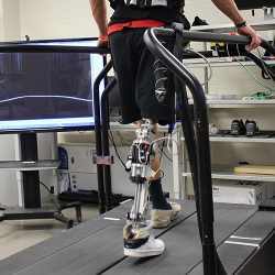 An amputee practices walking with a powered prosthetic leg.