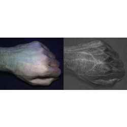 Compared to an image taken with a normal camera (left), a HyperCam image (right) reveals detailed vein and skin texture patterns that are unique to each individual.